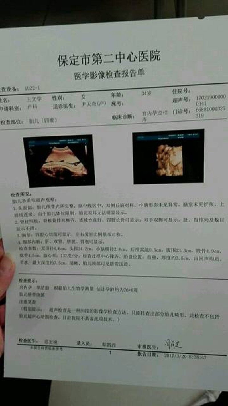 孕期检查的重要性与保定的专业服务